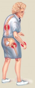 ortopedia+regenerativa+a+dolor+ciatico+rodilla+espalda+consulta+50+mexicali+baja+california+mexico__644B35_5
